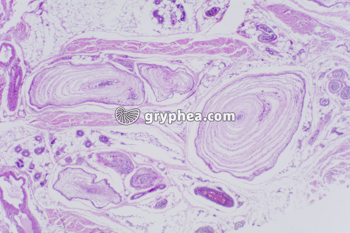 Peau du doigt avec corpuscules de Pacini x10 - gryphea.com